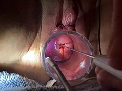Speculum makes the chicks achieve the orgasms